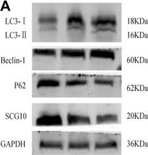 Fig.7.A showing Western Blotting from the publication: Total flavonoids of hawthorn leaves protect spinal motor neurons via promotion of autophagy after spinal cord injury.
