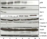 Fig.5.A showing Western Blotting in a Homo sapiens (Human) sample from the publication: Alsterpaullone, a Cyclin-Dependent Kinase Inhibitor, Mediated Toxicity in HeLa Cells through Apoptosis-Inducing Effect.