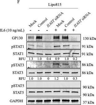 Fig.1.F showing Western Blotting in a Homo sapiens (Human) sample from the publication: Blockade of interleukin-6 (IL-6) signaling in dedifferentiated liposarcoma (DDLPS) decreases mouse double minute 2 (MDM2) oncogenicity via alternative splicing.