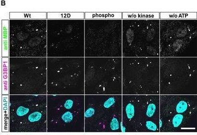Fig.5.B showing Immunocytochemistry-immunofluorescence from the publication: Disease-linked TDP-43 hyperphosphorylation suppresses TDP-43 condensation and aggregation.