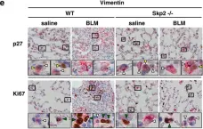 Fig.4.E showing Immunohistochemistry in a Mus musculus (House mouse) sample from the publication: Inhibiting Skp2 E3 Ligase Suppresses Bleomycin-Induced Pulmonary Fibrosis.
