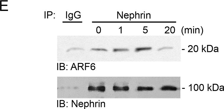 ARF6 mediates nephrin tyrosine phosphorylation-induced podocyte cellular dynamics.