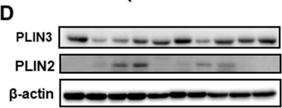 Lipid Droplets in Lung Cancers Are Crucial for the Cell Growth and Starvation Survival.
