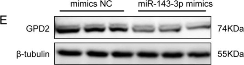 Fig.6.E showing Western Blotting from the publication: Effect of miR-143-3p from Extracellular Vesicles of Porcine Uterine Luminal Fluid on Porcine Trophoblast Cells.