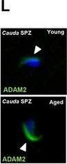 Fig.1.L showing Immunocytochemistry-immunofluorescence in a Mus musculus (House mouse) sample from the publication: Deciphering the Contribution of Circular RNAs to Age-Related Decline in Sertoli Cell Survivor.