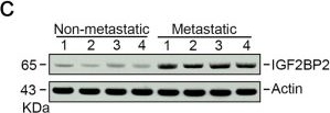 Fig.2.C showing Western Blotting from the publication: m6A modified BACE1-AS contributes to liver metastasis and stemness-like properties in colorectal cancer through TUFT1 dependent activation of Wnt signaling.