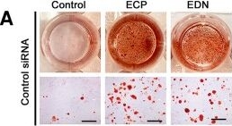 Fig.8.A showing Immunohistochemistry from the publication: Cationic proteins from eosinophils bind bone morphogenetic protein receptors promoting vascular calcification and atherogenesis.