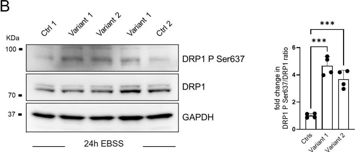 Fig.3.B showing Western Blotting from the publication: Converging Role for REEP1/SPG31 in Oxidative Stress.