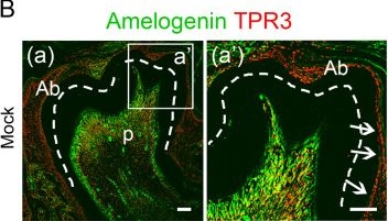 Fig.8.B showing Immunohistochemistry-immunofluorescence from the publication: Genome-wide screening for deubiquitinase subfamily identifies ubiquitin-specific protease 49 as a novel regulator of odontogenesis.