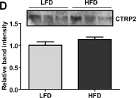 Fig.1.D showing Western Blotting from the publication: CTRP2 overexpression improves insulin and lipid tolerance in diet-induced obese mice.
