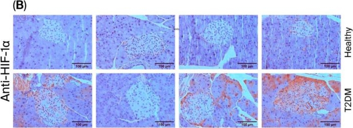 Fig.3.B showing Immunohistochemistry in a Mus musculus (House mouse) sample from the publication: Transient Overexpression of pVHL Mediated by Adenoviral Vector Injection in Pancreatic Tissue Decreases Blood Glucose Levels in a Hypercaloric Diet-Induced Mouse Model of Type 2 Diabetes Mellitus.