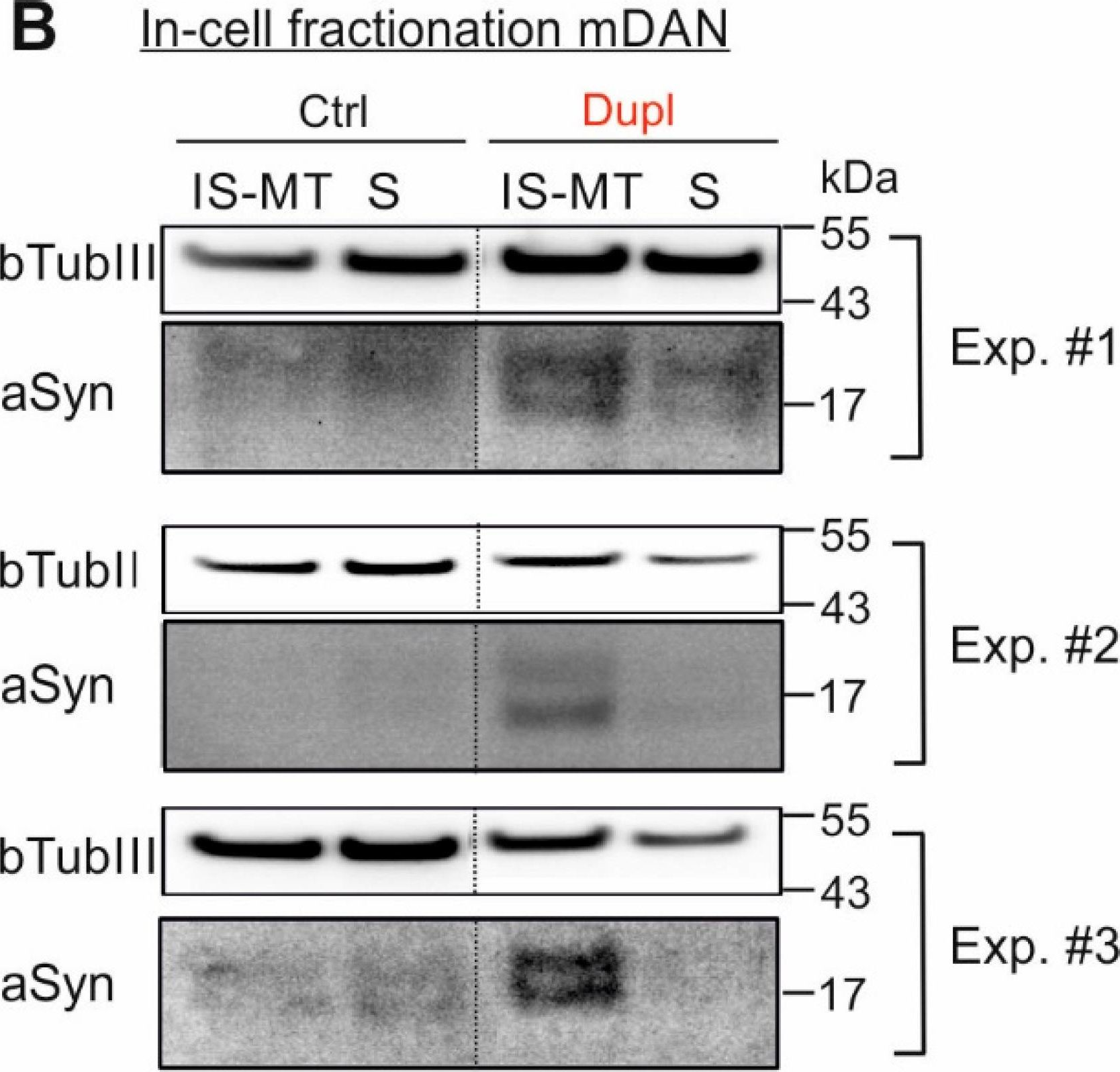 Fig.5.B showing Western Blotting in a Homo sapiens (Human) sample from the publication: Interaction of Alpha Synuclein and Microtubule Organization Is Linked to Impaired Neuritic Integrity in Parkinson's Patient-Derived Neuronal Cells.