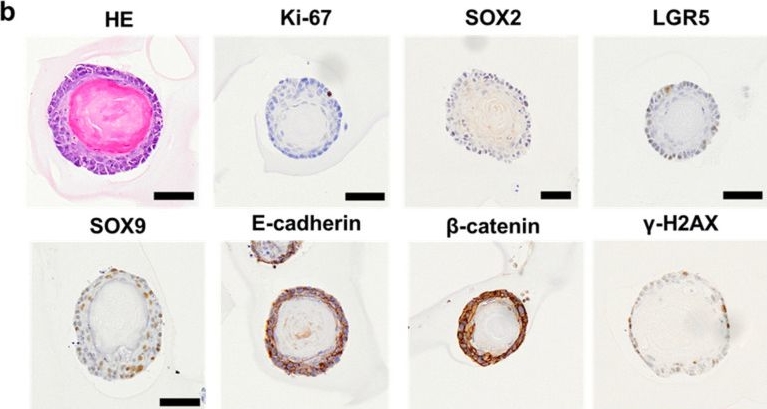 Fig.5.B showing Immunohistochemistry in a Mus musculus (House mouse) sample from the publication: Anorectal Remodeling in the Transitional Zone with Increased Expression of LGR5, SOX9, SOX2, and Keratin 13 and 5 in a Dextran Sodium Sulfate-Induced Mouse Model of Ulcerative Colitis.