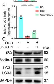 Fig.2.P showing Western Blotting from the publication: "Membrane-Guided" Repair Strategy: Precision Delivery of GGT1 Degrader for Targeted Repair and Regeneration of Spinal Cord Neurons.