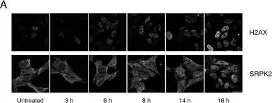 Fig.5.A showing Immunocytochemistry-immunofluorescence in a Homo sapiens (Human) sample from the publication: Paraquat modulates alternative pre-mRNA splicing by modifying the intracellular distribution of SRPK2.