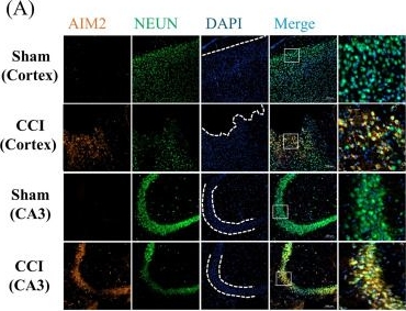 Fig.3.A showing Immunocytochemistry-immunofluorescence in a Mus musculus (House mouse) sample from the publication: A self-perpetuating neuron-intrinsic GSDMD-mtDNA-AIM2 inflammasome axis drives neuronal pyroptosis and cognitive impairment after traumatic brain injury.