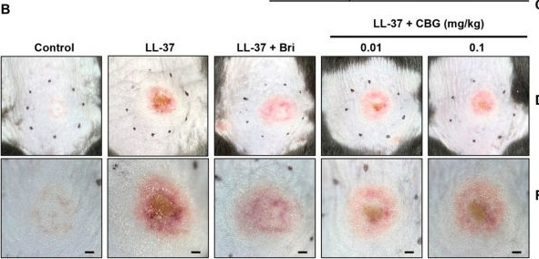 Fig.1.B from the publication: Targeting Vascular and Inflammatory Crosstalk: Cannabigerol as a Dual-Pathway Modulator in Rosacea.