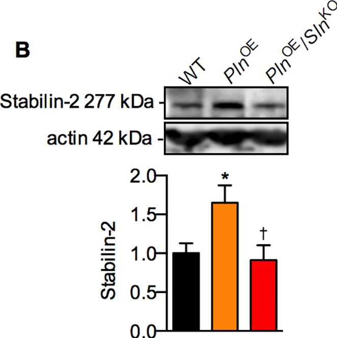 Fig.5.B showing Western Blotting in a Mus musculus (House mouse) sample from the publication: Sarcolipin deletion exacerbates soleus muscle atrophy and weakness in phospholamban overexpressing mice.