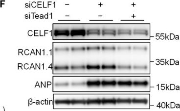 Fig.4.F showing Western Blotting from the publication: CELF1 Downregulation Promotes Cardiomyocyte Hypertrophy via Regulating Alternative Splicing of Tead1.