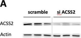 Fig.1.A showing Western Blotting from the publication: Acetyl-CoA synthetase (ACSS2) does not generate butyryl- and crotonyl-CoA.