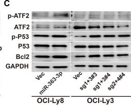 Fig.4.C showing Western Blotting in a Homo sapiens (Human) sample from the publication: MiRNA-363-3p/DUSP10/JNK axis mediates chemoresistance by enhancing DNA damage repair in diffuse large B-cell lymphoma.