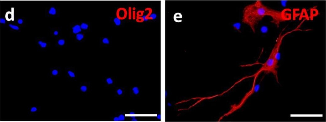 Fig.3.A showing Immunocytochemistry-immunofluorescence in a Rattus norvegicus (Rat) sample from the publication: Complement C5a Implication in Axonal Growth After Injury.