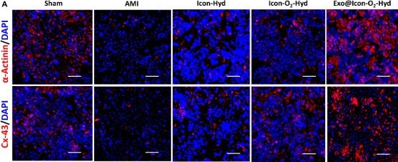 Fig.9.A showing Immunohistochemistry-immunofluorescence from the publication: Fabrication of a conductive, ionic liquid functionalized, oxygen-generating hydrogel loaded with ADSC-derived exosomes to enhance angiogenesis and cardiac repair after acute myocardial infarction.