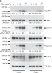 Fig.3.A showing Western Blotting from the publication: Biallelic JAK1 mutations in immunodeficient patient with mycobacterial infection.