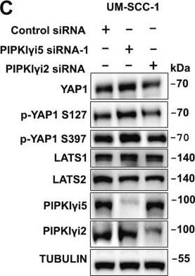 Fig.4.C showing Western Blotting from the publication: Type I gamma phosphatidylinositol phosphate kinase i5 suppresses YAP1 signaling.