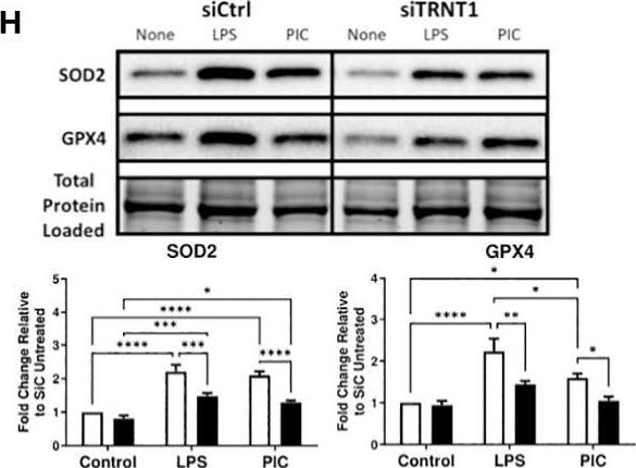 Fig.2.H showing Western Blotting from the publication: SIFD-associated TRNT1 deficiency unveils importance of TSPO during macrophage antibacterial and antiviral responses.