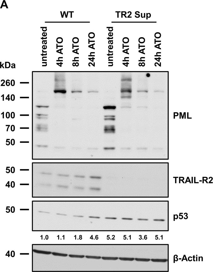 Fig.7.A showing Western Blotting in a Homo sapiens (Human) sample from the publication: TRAIL-receptor 2-a novel negative regulator of p53.