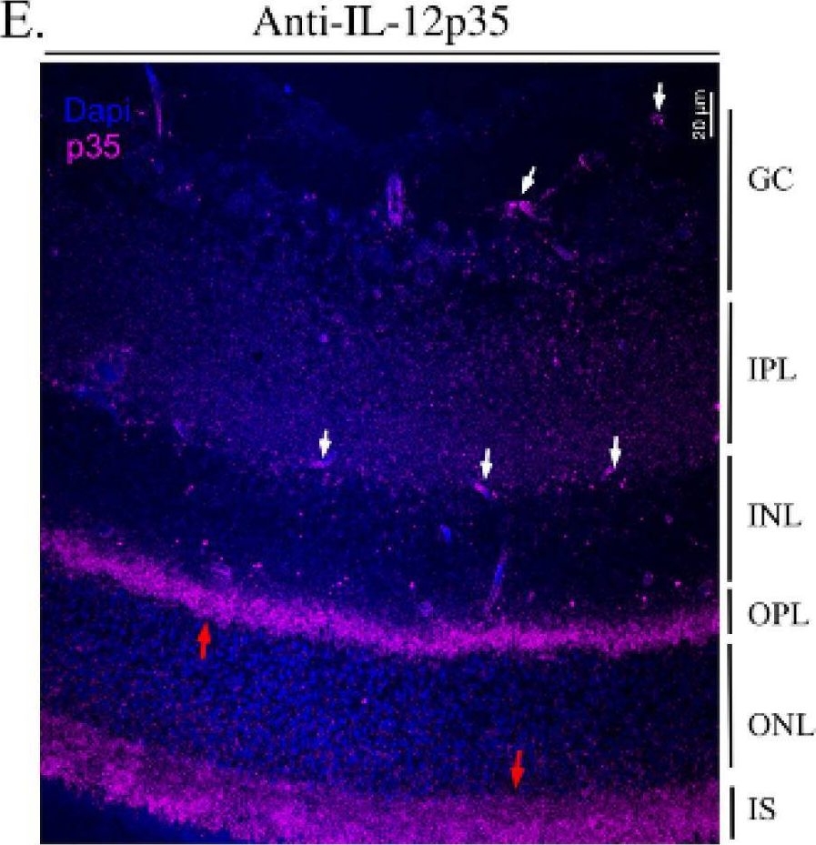 Fig.3.E showing Immunohistochemistry-immunofluorescence from the publication: Photoreceptor Cells Constitutively Express IL-35 and Promote Ocular Immune Privilege.