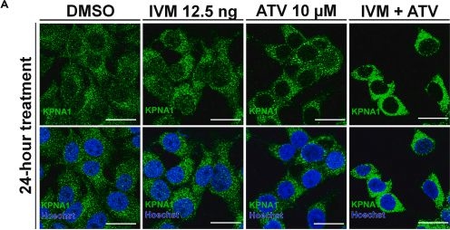 Fig.5.A showing Immunocytochemistry-immunofluorescence in a Dengue virus sample from the publication: Protocol to evaluate the antiviral effect of FDA-approved drugs against dengue virus in Huh7 cells and AG129 mice.