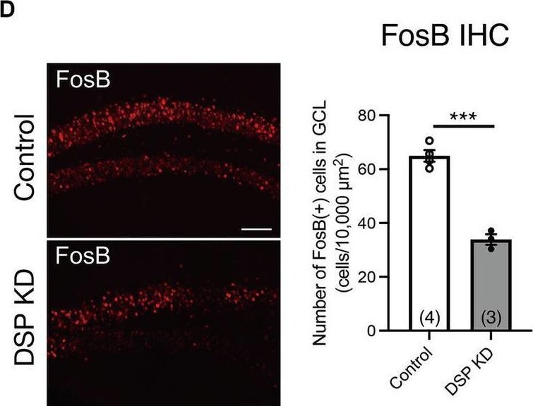 Fig.2.D showing Immunohistochemistry-immunofluorescence from the publication: Role of desmoplakin in supporting neuronal activity, neurogenic processes, and emotional-related behaviors in the dentate gyrus.
