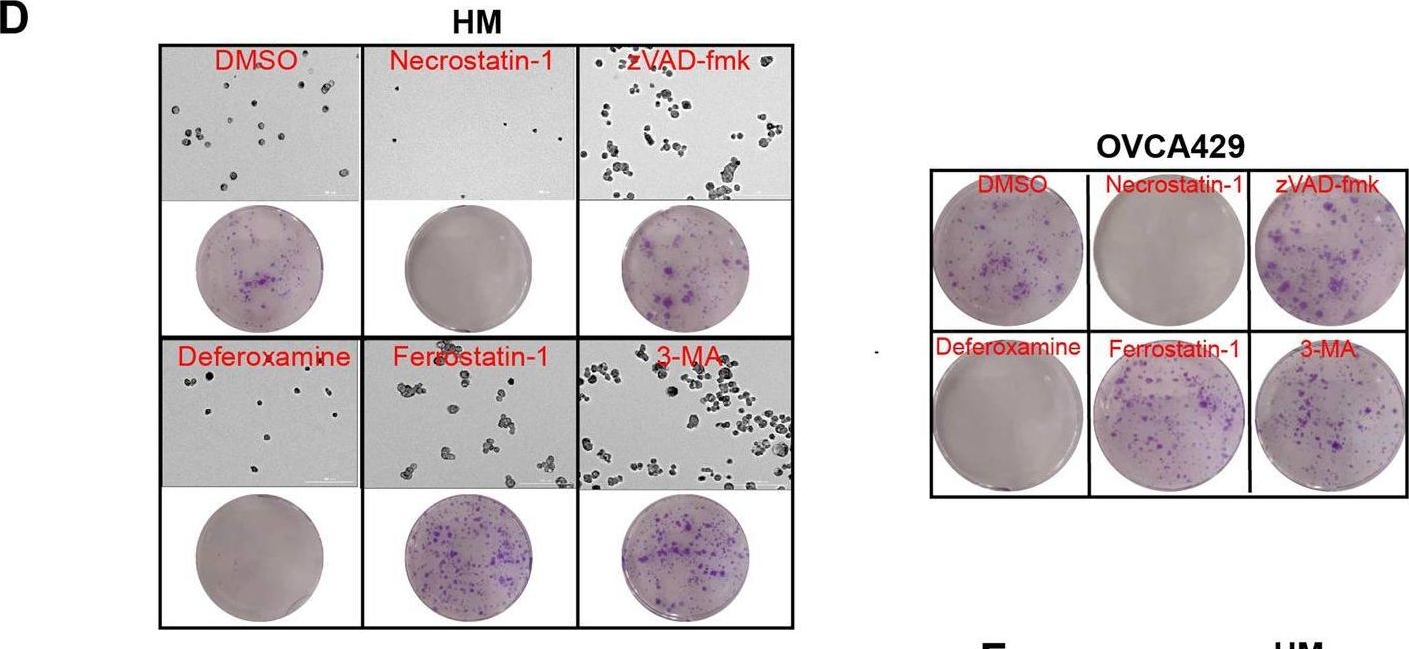 Fig.1.D from the publication: ACSL1-induced ferroptosis and platinum resistance in ovarian cancer by increasing FSP1 N-myristylation and stability.