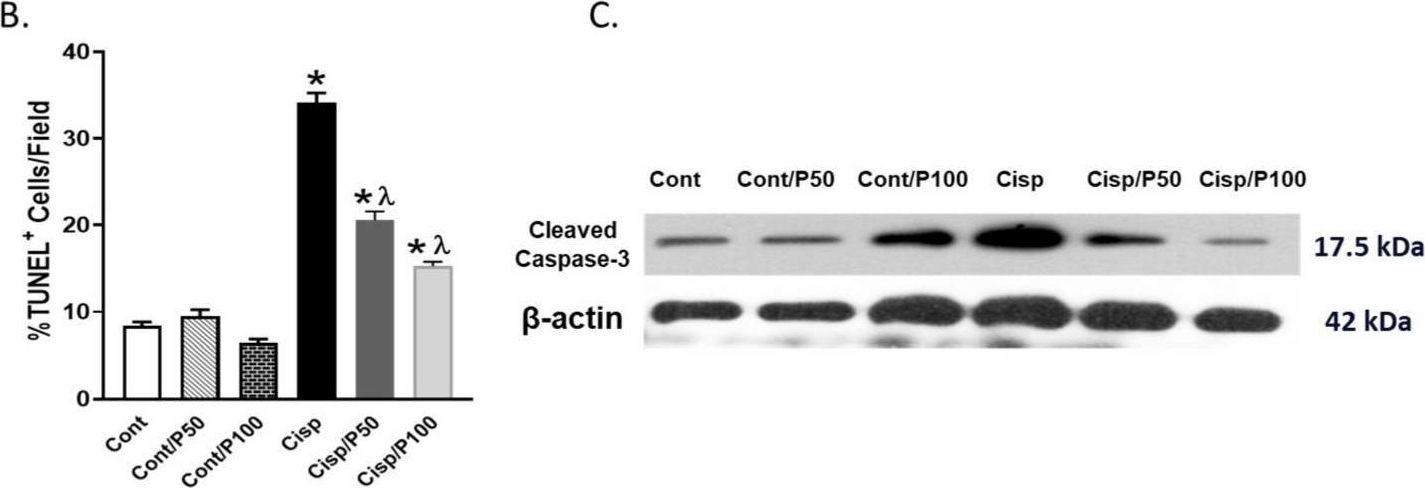 Fig.5.B showing Western Blotting from the publication: Protocatechuic Acid Ameliorates Cisplatin-Induced Inflammation and Apoptosis in Mouse Proximal Tubular Cells.