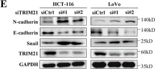 Fig.3.E showing Western Blotting from the publication: TRIM21-mediated PRMT1 degradation attenuates colorectal cancer malignant progression.