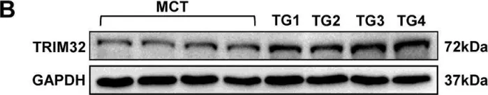 Fig.3.B showing Western Blotting in a Mus musculus (House mouse) sample from the publication: Tripartite motif 32 prevents pathological cardiac hypertrophy.