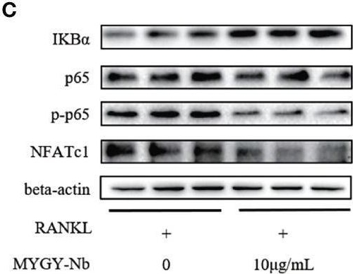 Fig.6.C showing Western Blotting from the publication: N-Butanol Extract of Modified You-Gui-Yin Attenuates Osteoclastogenesis and Ameliorates Osteoporosis by Inhibiting RANKL-Mediated NF-κB Signaling.