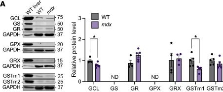 Fig.2.A showing Western Blotting from the publication: Impaired hydrogen sulfide biosynthesis underlies eccentric contraction-induced force loss in dystrophin-deficient skeletal muscle.