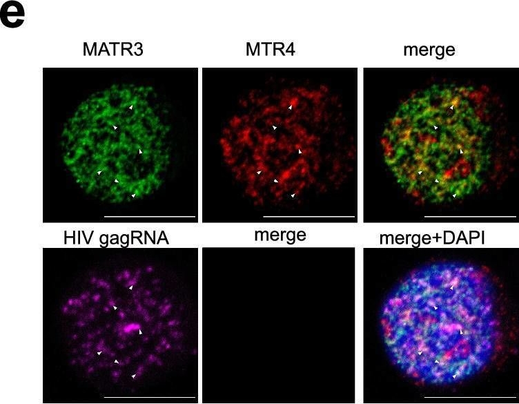Fig.2.E showing Immunocytochemistry-immunofluorescence in a Homo sapiens (Human) sample from the publication: Nuclear retention of unspliced HIV-1 RNA as a reversible post-transcriptional block in latency.