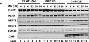 Fig.5.A showing Western Blotting in a Homo sapiens (Human) sample from the publication: CHIP/STUB1 Ubiquitin Ligase Functions as a Negative Regulator of ErbB2 by Promoting Its Early Post-Biosynthesis Degradation.