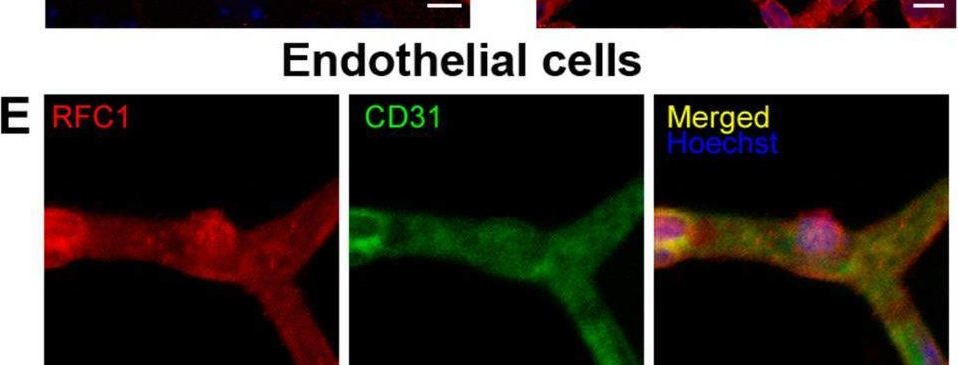 Fig.1.E showing Immunohistochemistry-immunofluorescence in a Mus musculus (House mouse) sample from the publication: Reduced folate carrier 1 is present in retinal microvessels and crucial for the inner blood retinal barrier integrity.