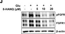 Fig.5.J showing Western Blotting from the publication: 8-Hydroxy-2-Anilino-1,4-Naphthoquinone Prevents Against Ferroptotic Neuronal Death and Kainate-Induced Epileptic Seizures.