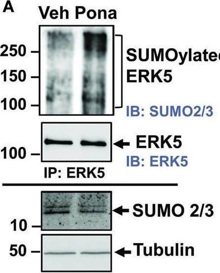 Fig.3.A showing Western Blotting in a Homo sapiens (Human) sample from the publication: Ponatinib Activates an Inflammatory Response in Endothelial Cells via ERK5 SUMOylation.
