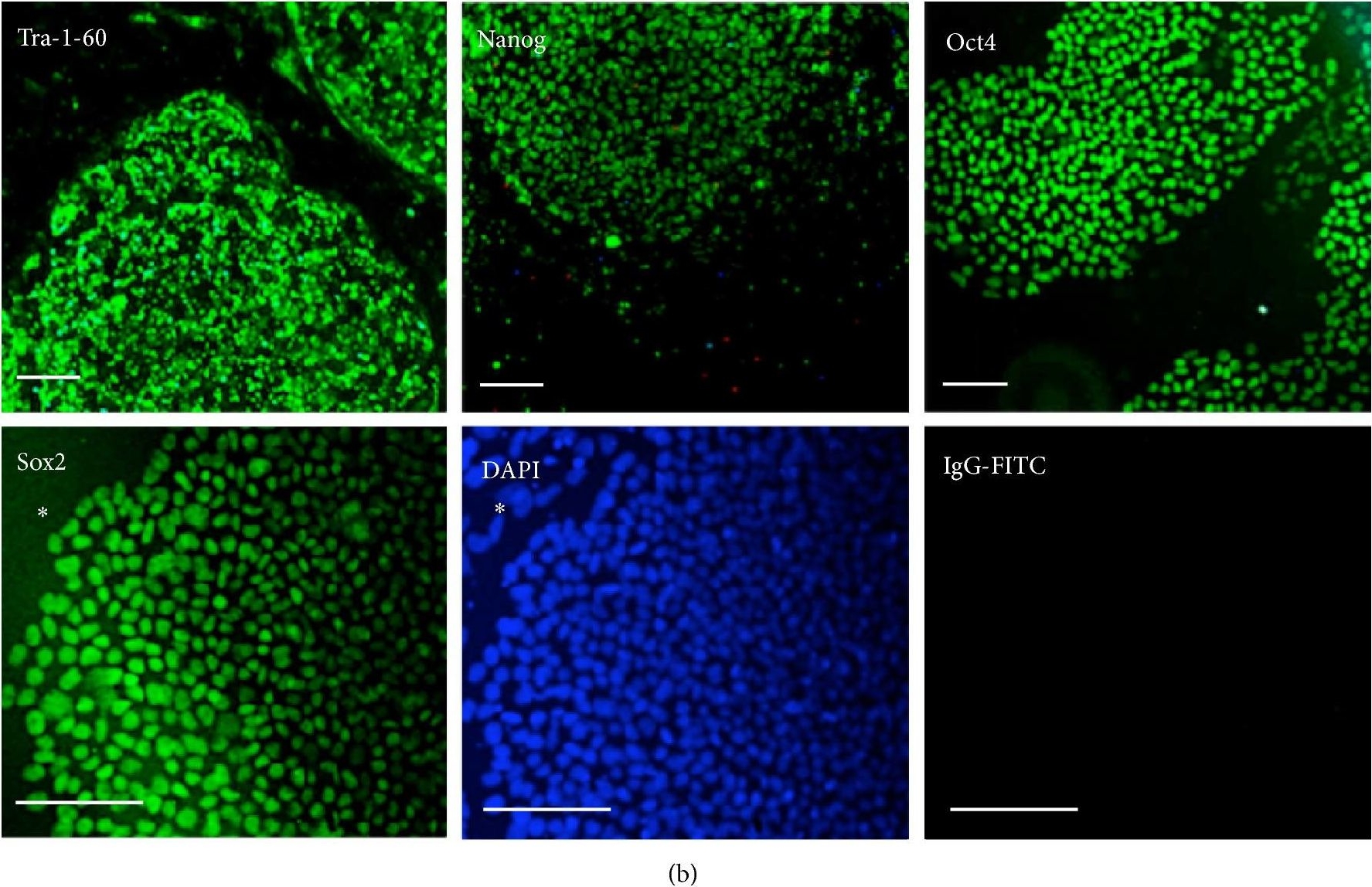 Fig.2.B showing Immunocytochemistry in a Homo sapiens (Human) sample from the publication: Preferential Lineage-Specific Differentiation of Osteoblast-Derived Induced Pluripotent Stem Cells into Osteoprogenitors.