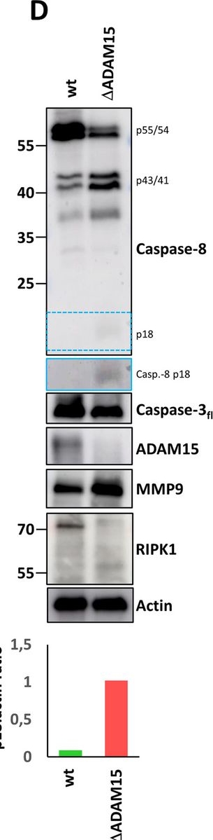 Fig.4.D showing Western Blotting in a Homo sapiens (Human) sample from the publication: Loss of ADAM15 prevents necroptosis induction by partial RIPK1 degradation due to enhanced TNF-R1 surface expression and basal caspase-8 activation.