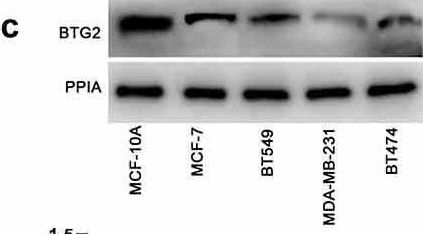 Fig.4.C showing Western Blotting in a Homo sapiens (Human) sample from the publication: MicroRNA miR-92a-3p regulates breast cancer cell proliferation and metastasis via regulating B-cell translocation gene 2 (BTG2).