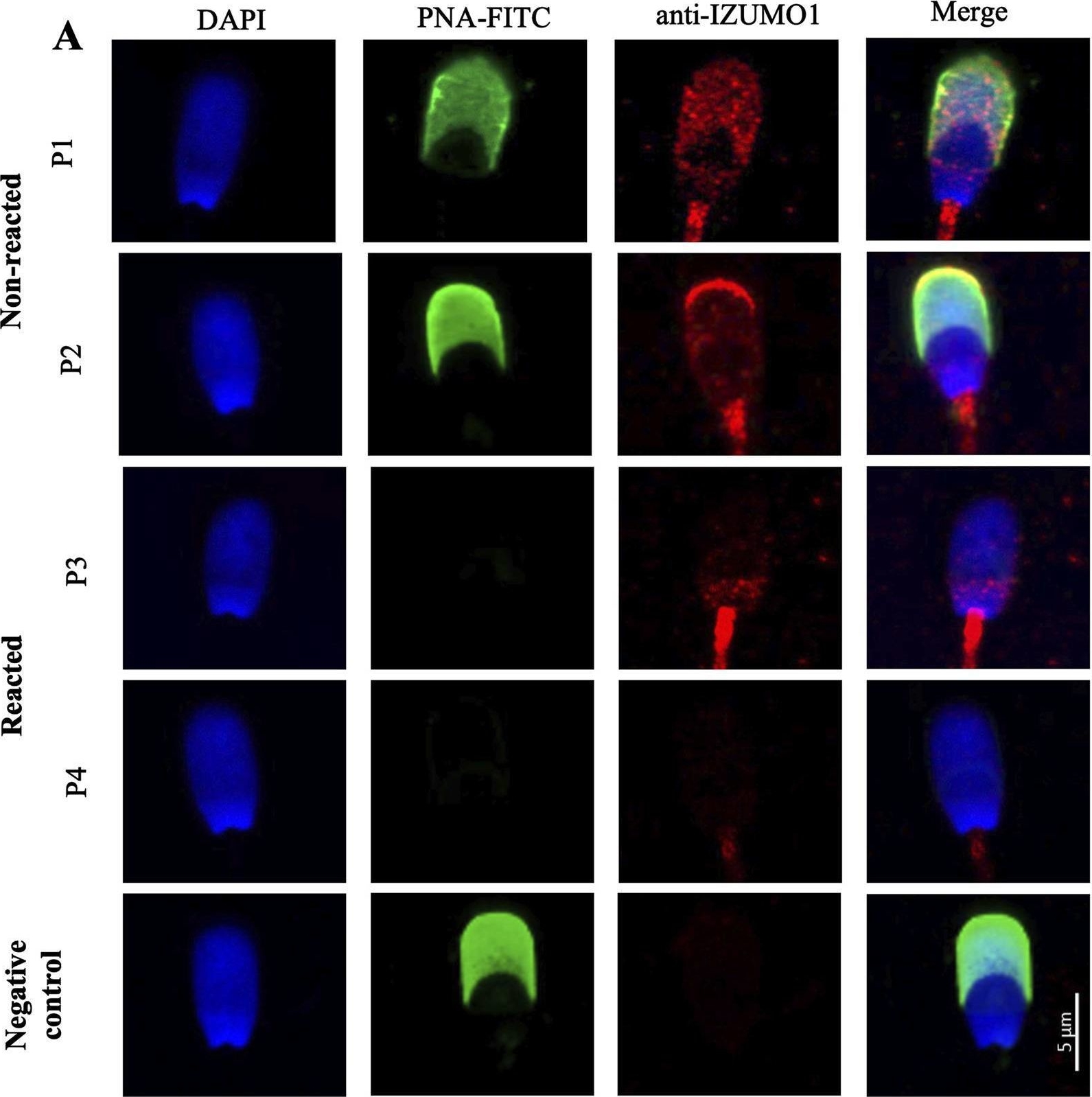 Fig.1.A showing Immunocytochemistry-immunofluorescence from the publication: Immunolocalization and proteomic analyses of IZUMO1 in porcine spermatozoa.