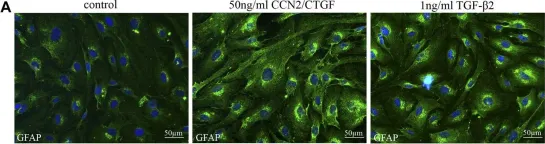 Goat Anti-Rabbit IgG (H+L) Secondary Antibody, Cy3 Conjugated